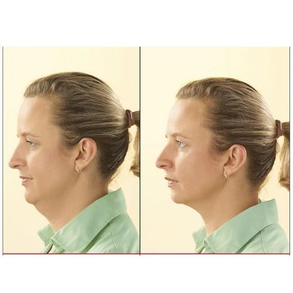 Masseur double menton