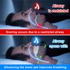 Adjustable Anti Snoring Mouth Guard Anti-Snoring Mouthpiece Sleeping Mouthpiece Device Bruxism Snoring Stopper Improve Sleep Aid