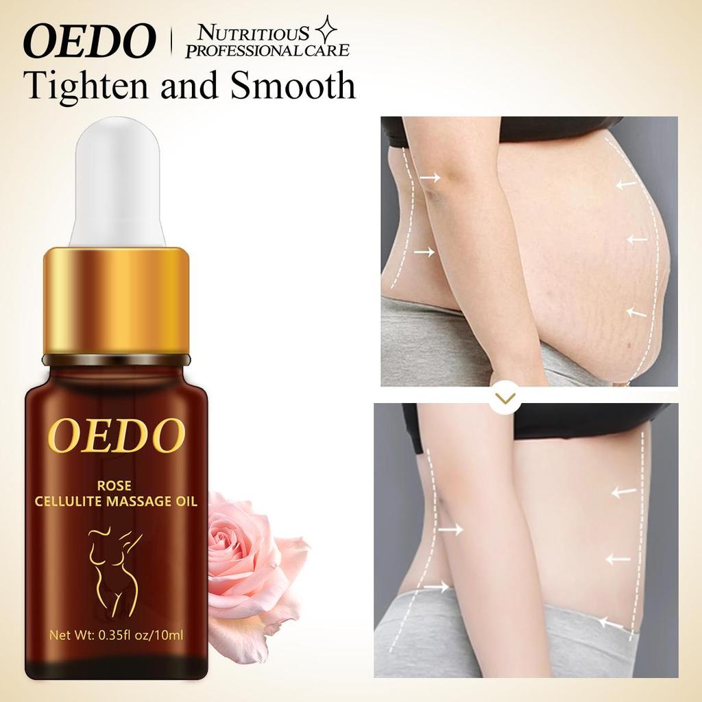 Slimming Cellulite Massage Essential Oil Body Care Weight Loss Promote Fat Burn Thin Waist Stovepipe Firming Skin Treatment