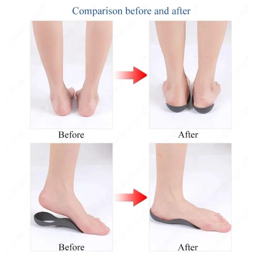 Comfortable Fasciitis Orthopedic Insoles Soft Foot Care Insert  Flat Feet