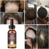 Rice Fermented Hair Growth Oil Essence Hair Oils Growth Serum Rich Nourishing Ingredients Promotes Thicker Stronger