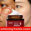 Whitening Freckle Cream Remove Melasma Spot Acne Pigment Melanin Dark Spots Pigmentation Freckle Removal Cream