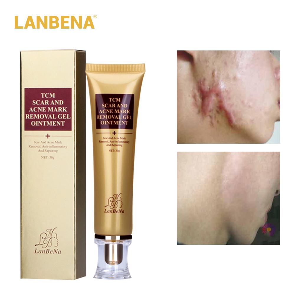 face products for acne scars