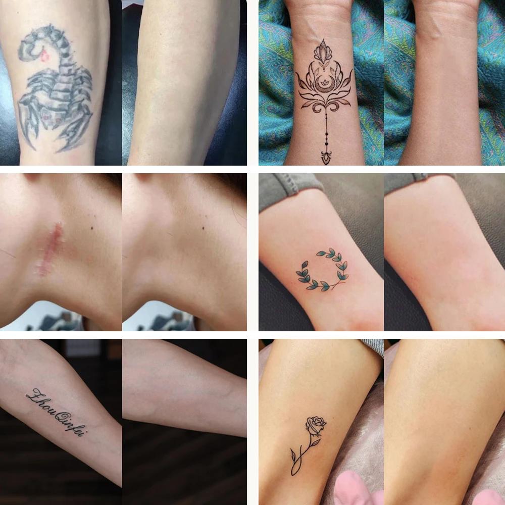 5 Stück Wasserdichte Concealer Tattoo Aufkleber Körper Arm Temporäre Makel Versteckende Tapes Abdeckpflaster Vollabdeckung Narbe Akne Abdeckung