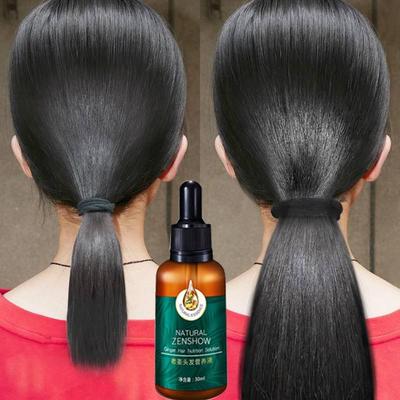 Olio essenziale per la crescita dei capelli allo zenzero Cura dei capelli a base di erbe Anti-caduta Ripara i follicoli piliferi Stimola la crescita dei capelli