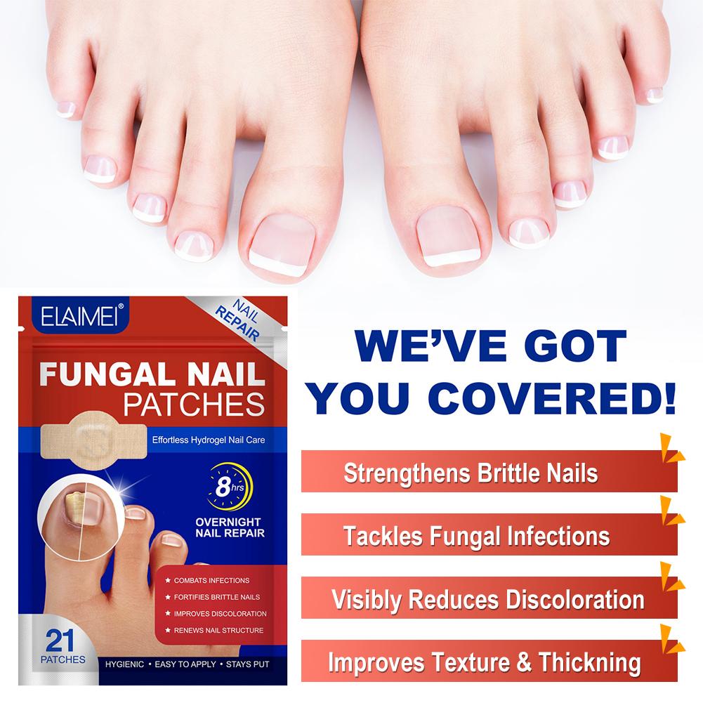 Szary plaster na paznokieć u stopy Plaster do naprawy paznokci grzybiczych Plaster korygujący wrastające paznokcie Pielęgnacja paznokci u stóp Plaster do leczenia zanokcicy 1/5 opakowań