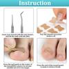 Ingrown Toenail Correction Patch Stickers Ingrown Toenail Treatment Lifter Toe Nail Patch Correction Buckle File Cuticle Pusher