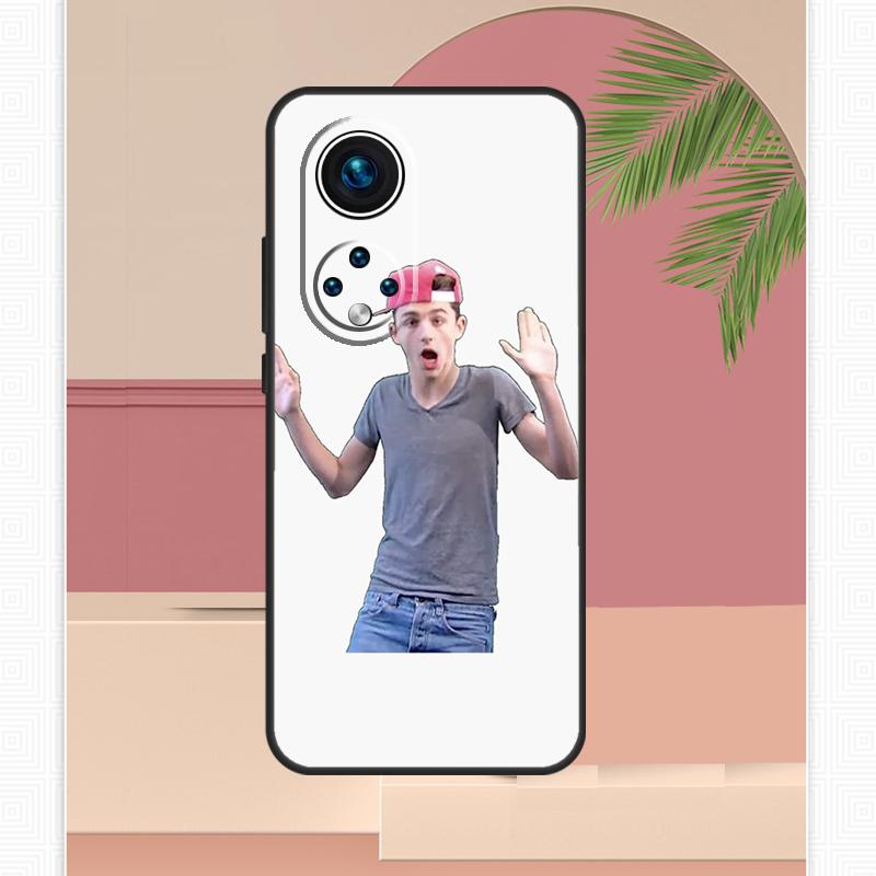 Timothee Chalamet Case For Honor Magic 7 Lite 5 6 8 Pro Honor 400 200 X9c X9b X9a X8b X8a X8c 50 70 90 Cover