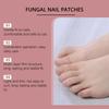 Fungal Nail Patches Hands And Feet Soft Nail Inlaid Nail Thickening Bright Nail Furrow Gray Nail Care Patch 32 PATCHES