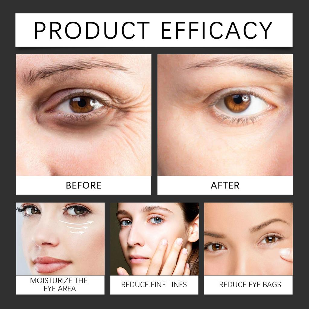 HOYGI Firming Eye Cream Fine Line Reducer Moisturizing Eye Gel Hydrating Tightening AntiAging Eye