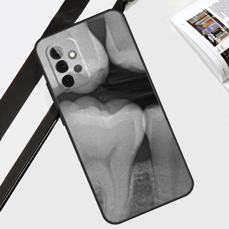 Dentist Dental Dent Tooth Case For Samsung Galaxy A06 A56 A36 A26 A16 A54 A34 A14 A12 A22 A32 A52 A13 A53 A15 A35 A55