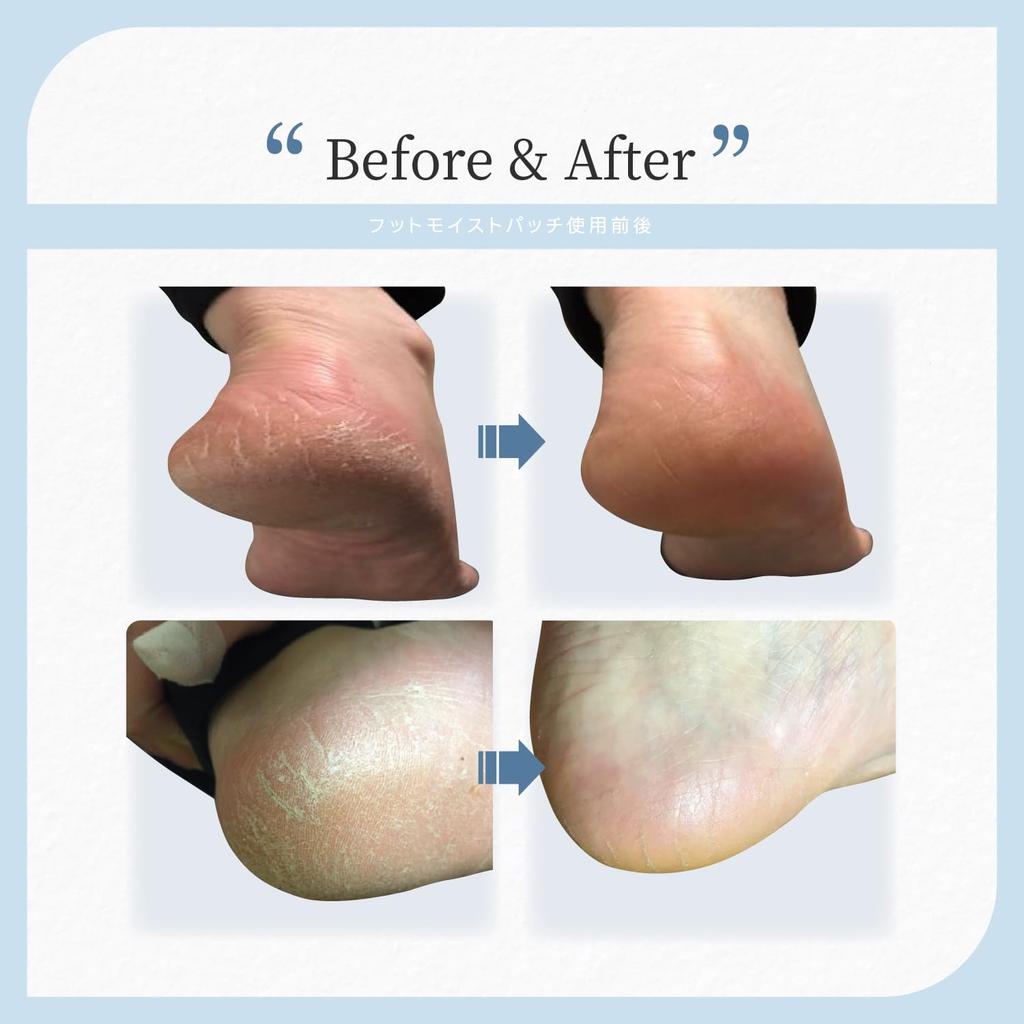Sleeping Heel Care Sheet Exfoliating Patch Moisturizing and exfoliating care at the same time Rough heels Foot care Gel sheet Hidden foot care Fixed
