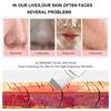 Ultrasonic Skin Care Spatula Vibration Blackhead Remover Cavitation Shovel Facial Exfoliation Skin Care Tools