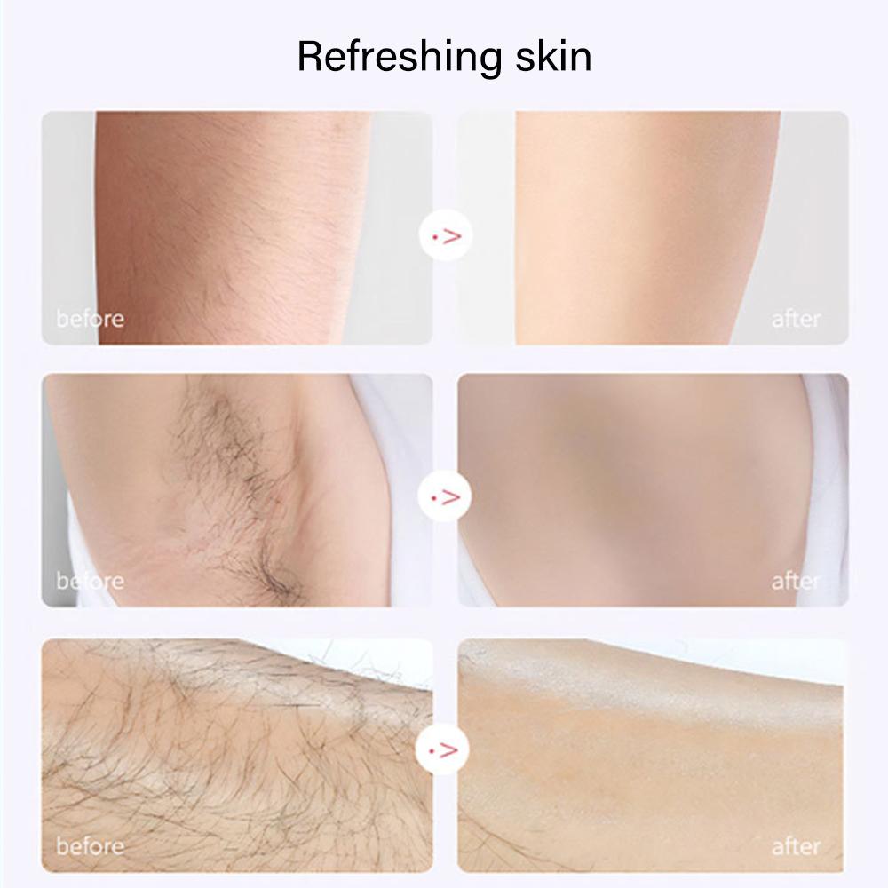 Epilator Electric Nedureros pentru Femei, Reîncărcabil, Aparat de Ras pentru Îndepărtarea Părului pentru Picior, Corp, Față, Buza Superioară, Bărbie, Trimmer Bikini