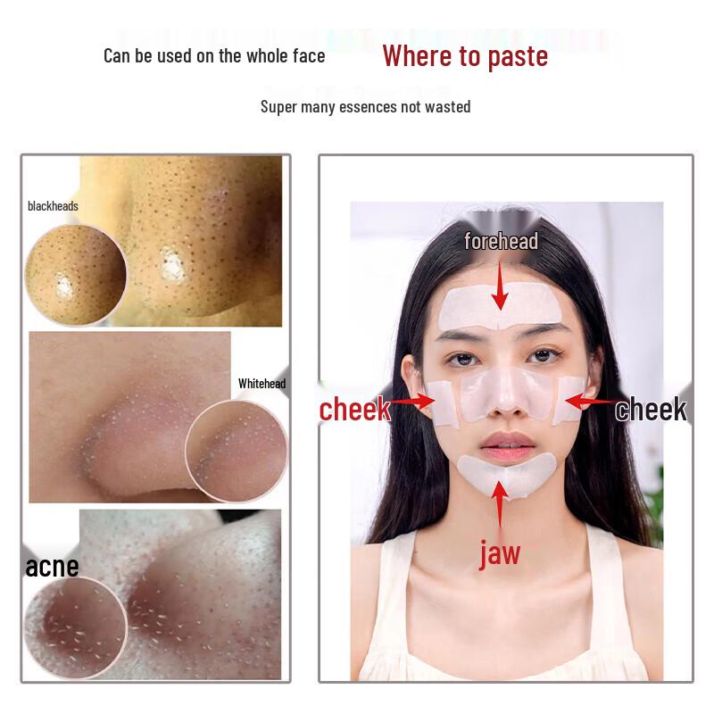 RNW Doppelt reinigende Mitesser-Nasenstreifen