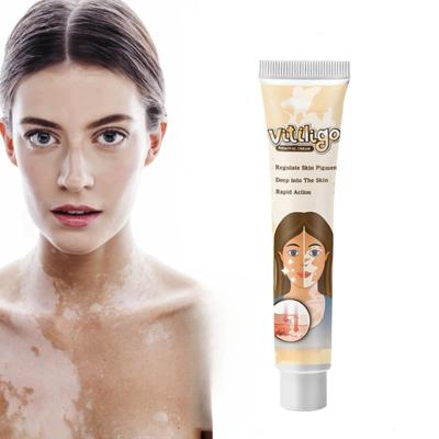 Treament Cream Antibacterials Psoriasiss Localized Ointment Mycosis Leukoplakia Plaster White Spot Cream