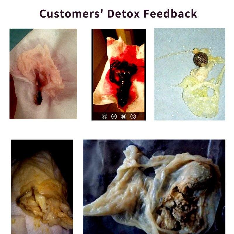 Women's Tampons For Cervical Erosion Vagina Cleaning Swab Uterine Fibroid Womb Health Care Clean Point Yoni Pearls Bulk