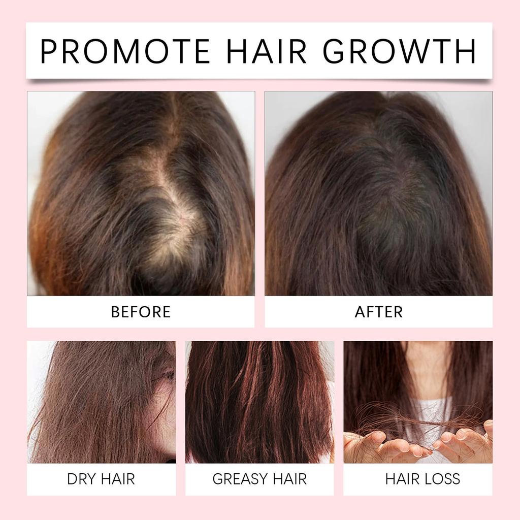Hair Growth Oil Nourishing Hair Serum Oil Helps With Growth And Reduces Breakage,100ml