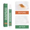 Portable Quick-Acting Laundry Stain Removal Pen - Oil, Red Wine & Ink Spot Cleaner, Greasy Decontamination 9g