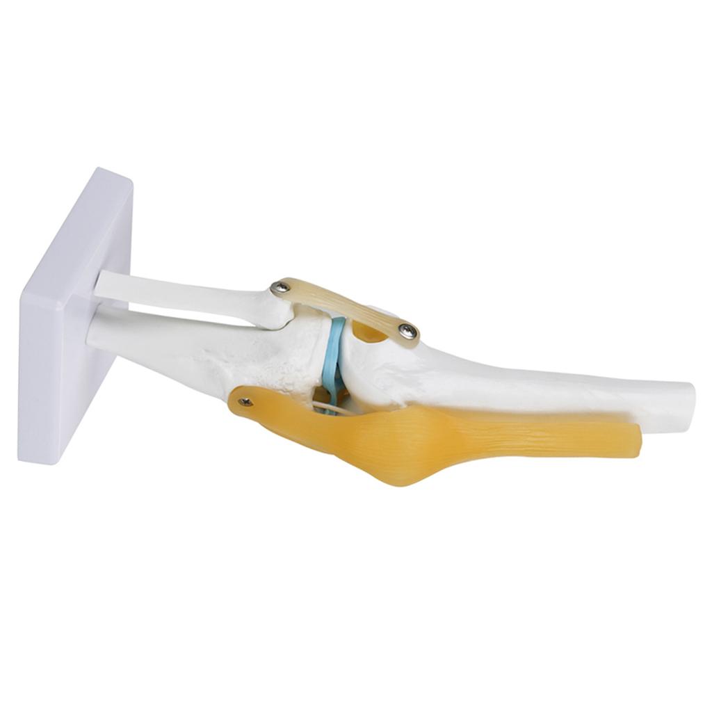 Life Size Human Knee Joint   Model for Skeleton Study Ideal for Hobbyists, Vividly Demonstrates Knee Mechanics with Ligament Model
