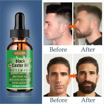 5ML/15ML/30ML/50ML/Siyah Hint Yağı Saç Büyümesini Besler Cilt Masajı Uçucu Yağ Kaş Büyümesi Cildin Yaşlanmasını Önler Saç Bakım Ürünleri