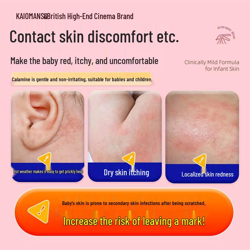 Kalomans Baby Calamine Soothing & Anti-Itch Cream