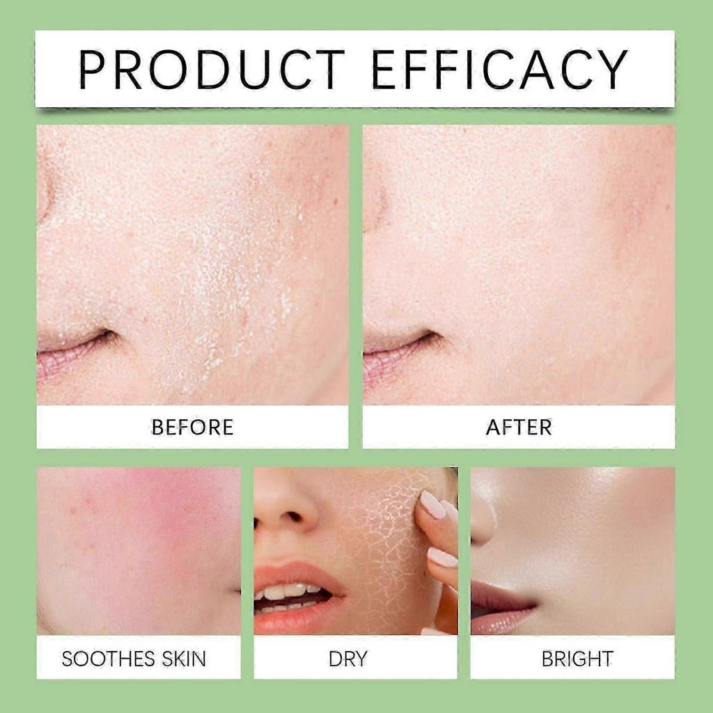 Anua Acido Azelaico 10 Acido Ialuronico Siero Lenitivo per Rossori, Siero Viso per Pelli Sensibili, Acido Ialuronico, Niacinamide, Trattamento Macchie