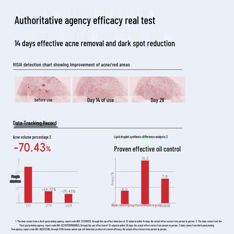 Hiruscar Azelainsäure 20% Akne Essenz Creme