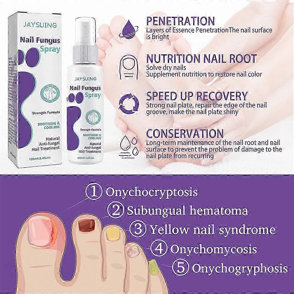 2Pcs Nail Fungus Spray, Toenail Fungus Treatment, Nail Care Solution for Toenail Feet, Fast Itch Relief