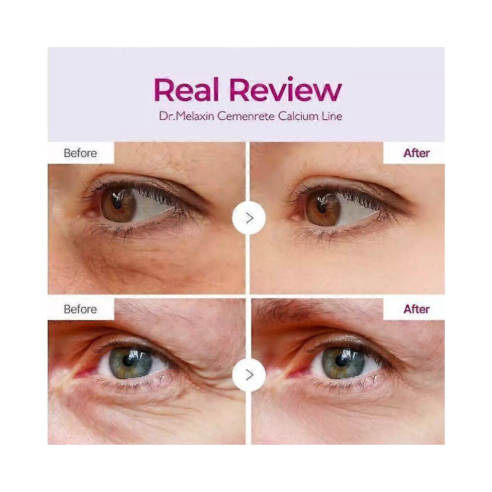 2x Crème Yeux Anti-Âge Dr.Melaxin Cemenrete Calcium Volume Multi Baume Stick Cœur Rides