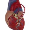 Modello Anatomico di Cuore Umano per Studio Cardiologico che Dimostra il Bypass Cardiaco