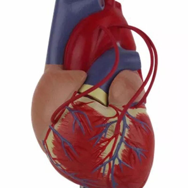 Modello Anatomico di Cuore Umano per Studio Cardiologico che Dimostra il Bypass Cardiaco