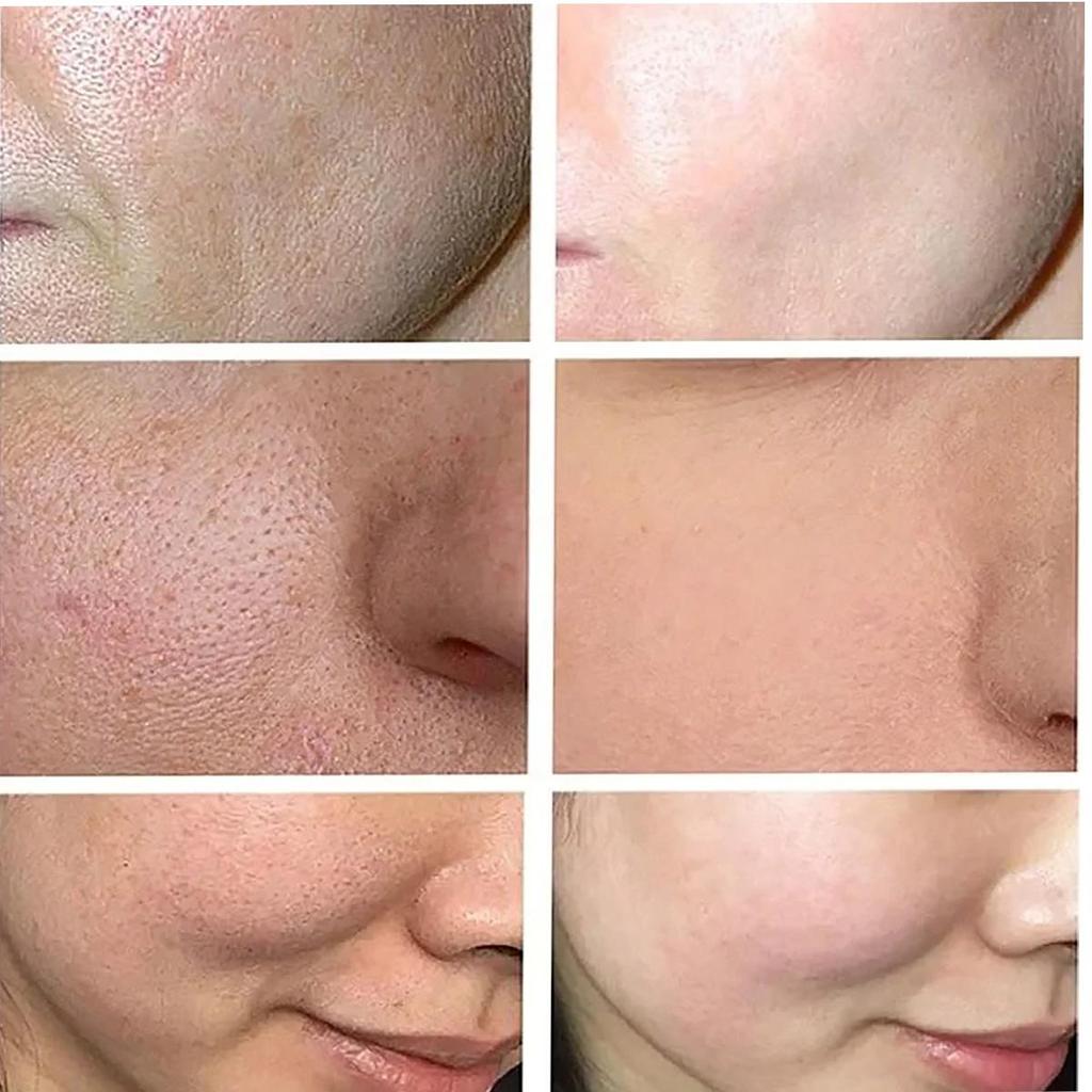 Hypoallergenic  Face Cream With Collagen & Hyaluronic Acid – Moisturizing, Firming, Wrinkle-Smoothing & Pore Shrinking - Suitable For All Skin Types