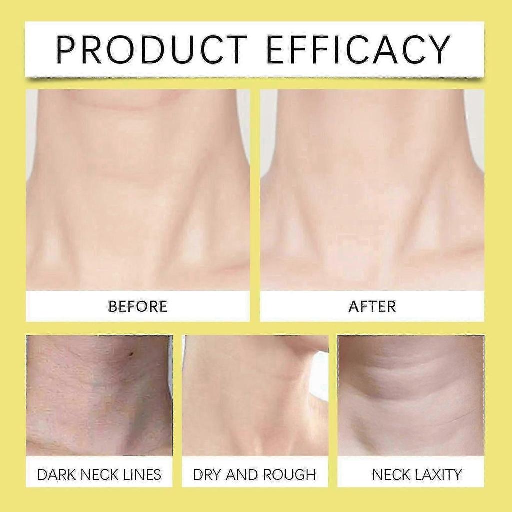 Neck Cream, Anti-Aging Neck Firming Cream, Hydrating & Tightening Neck Skin Treatment with Peptide, Anti Wrinkles, Lifts & Smooths Skin for Youthful L