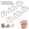 Nail Corrector Ingrown Toe Nail Wire Lifter Fixer Recover Tool Bunion Corrector for Pedicure Foot Care