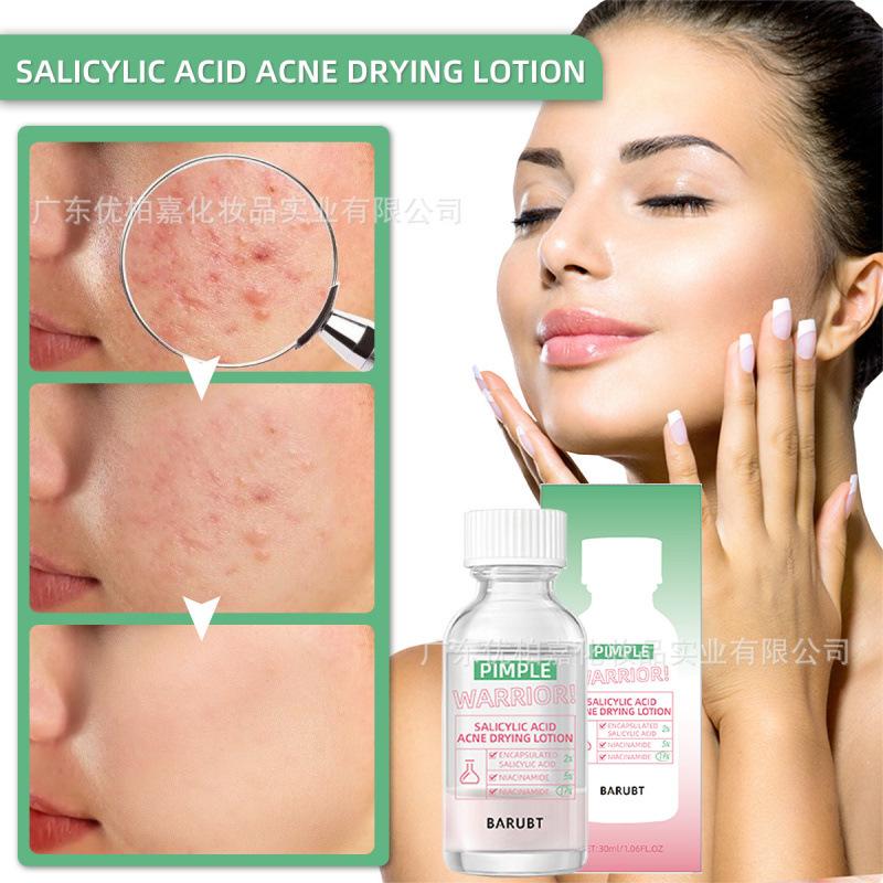 BARUBT Large Drops of Niacinamide Salicylic Acid Acne Essence, Quick Acne, Light Redness, Gentle Repair
