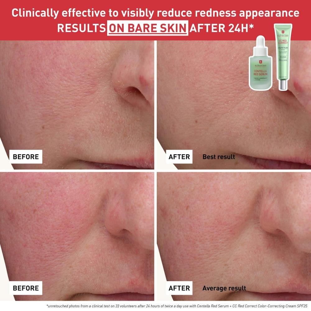 Erborian Centella Red Serum For Visible Redness 30 Ml