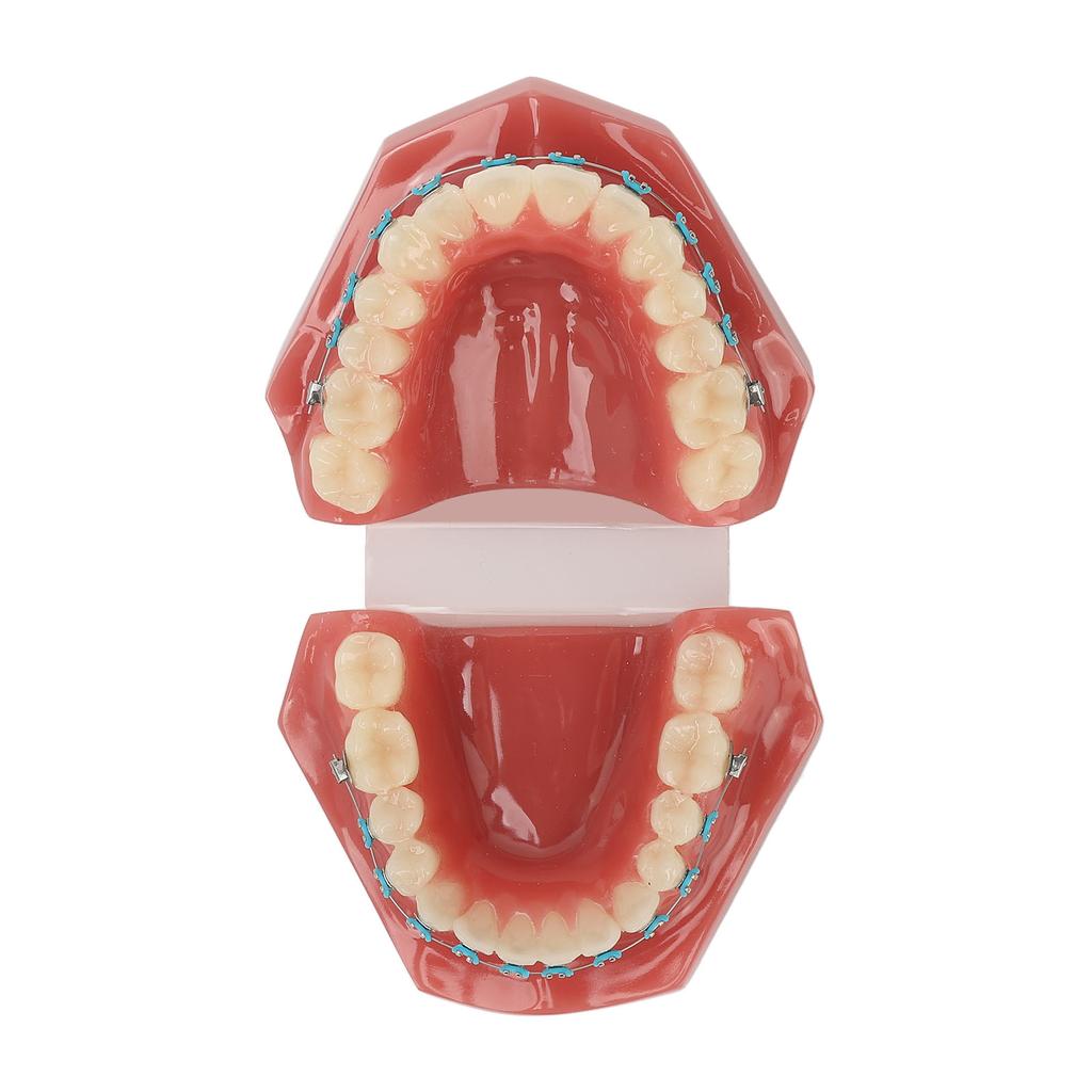 Zahnärztliches Kieferorthopädisches Modell 28 Zähne Harz Zahnärztliches Lehrmodell Zähne mit Metallbrackets