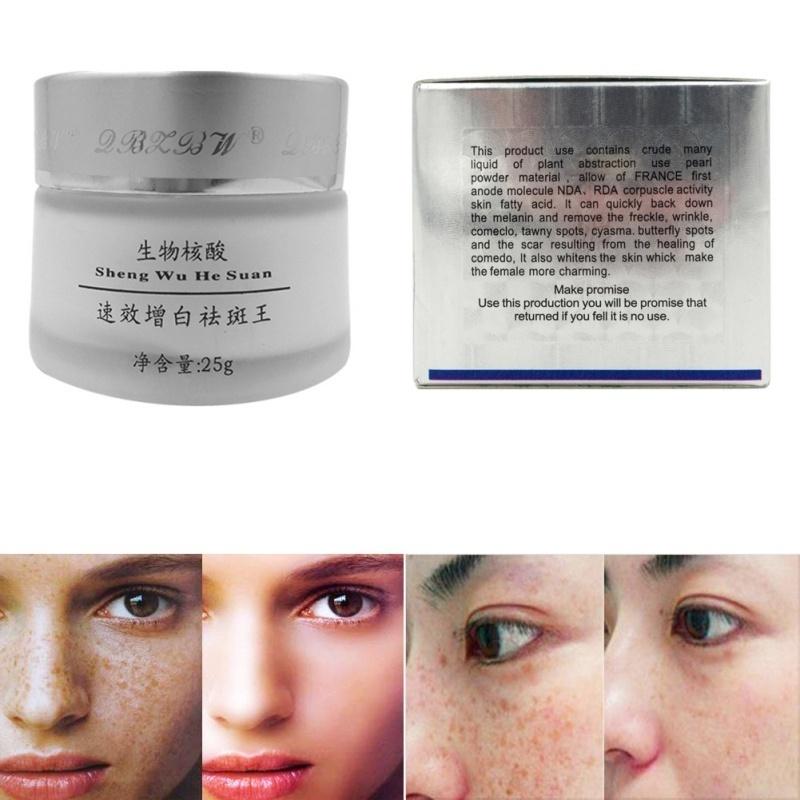 Women Strong Effects Powerful Whitening Freckle Cream Remove Melasma
