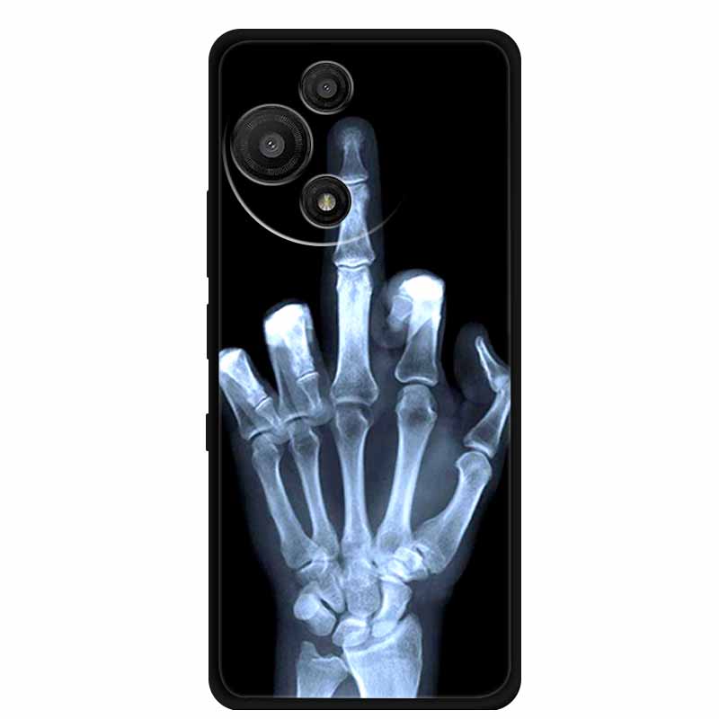 For TCL 60 SE Nxtpaper 5G Case 2025 TPU Soft Black Silicone Back Cover Case For TCL 60R Case 60 R Coque 6.7" Shockproof Fundas