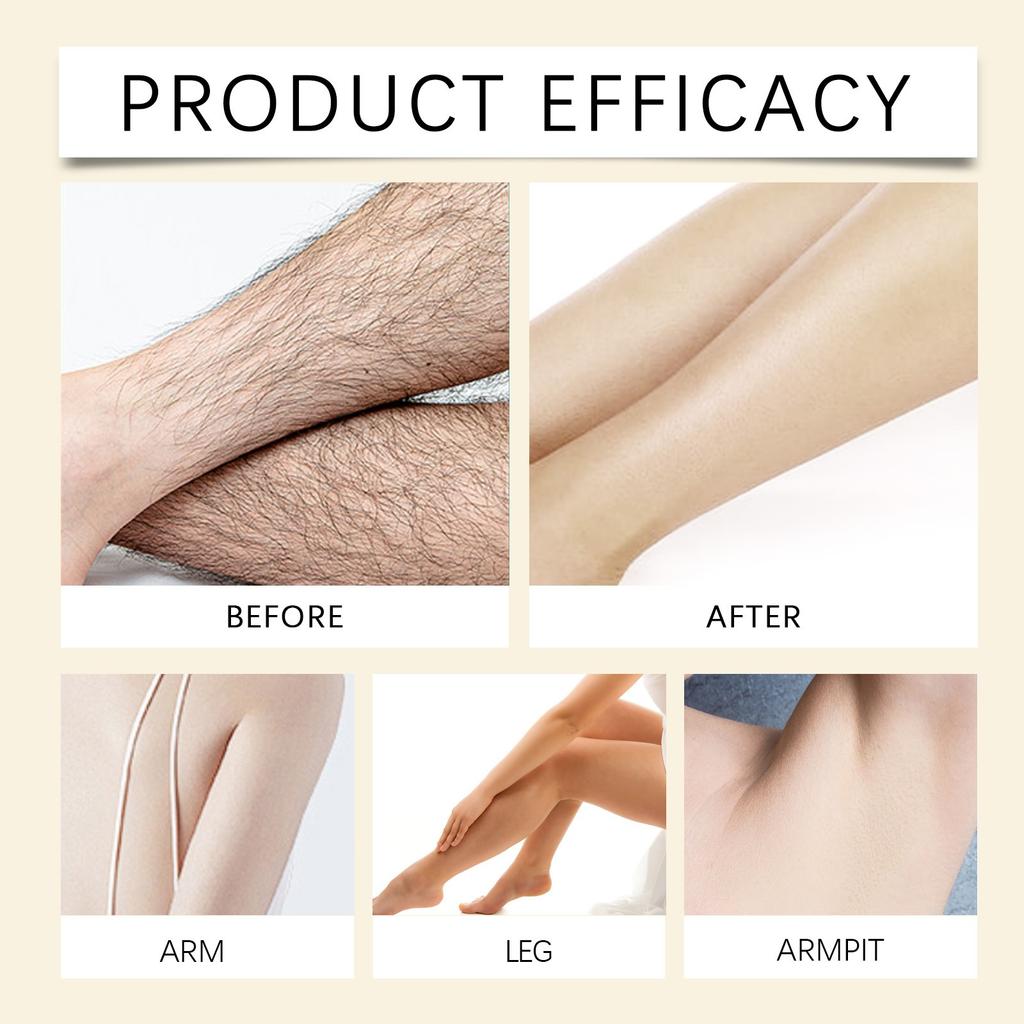 Rotundus Oil, A Hair Removal Aromatic Oil, Soothes Dryness And Redness, And Is Used For Hair Removal And Reducing Body Hair Growth,60ml