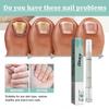 5x Nail Care Pen, Nail Fungus Austrian Experiences, Nail Care Pen Experiences, Nail Fungus Treatment Quick Intensive, Nail Repair Remover