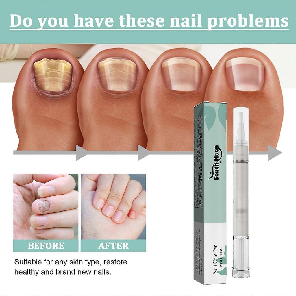 5x Nail Care Pen, Nail Fungus Austrian Experiences, Nail Care Pen Experiences, Nail Fungus Treatment Quick Intensive, Nail Repair Remover