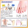 SUPORYA Pinky Toe for Ingrown Small Toe Corrective Spreads Interdigital Toe Protection Gel Easy to Put On and Take Prevents Beautiful For Home and