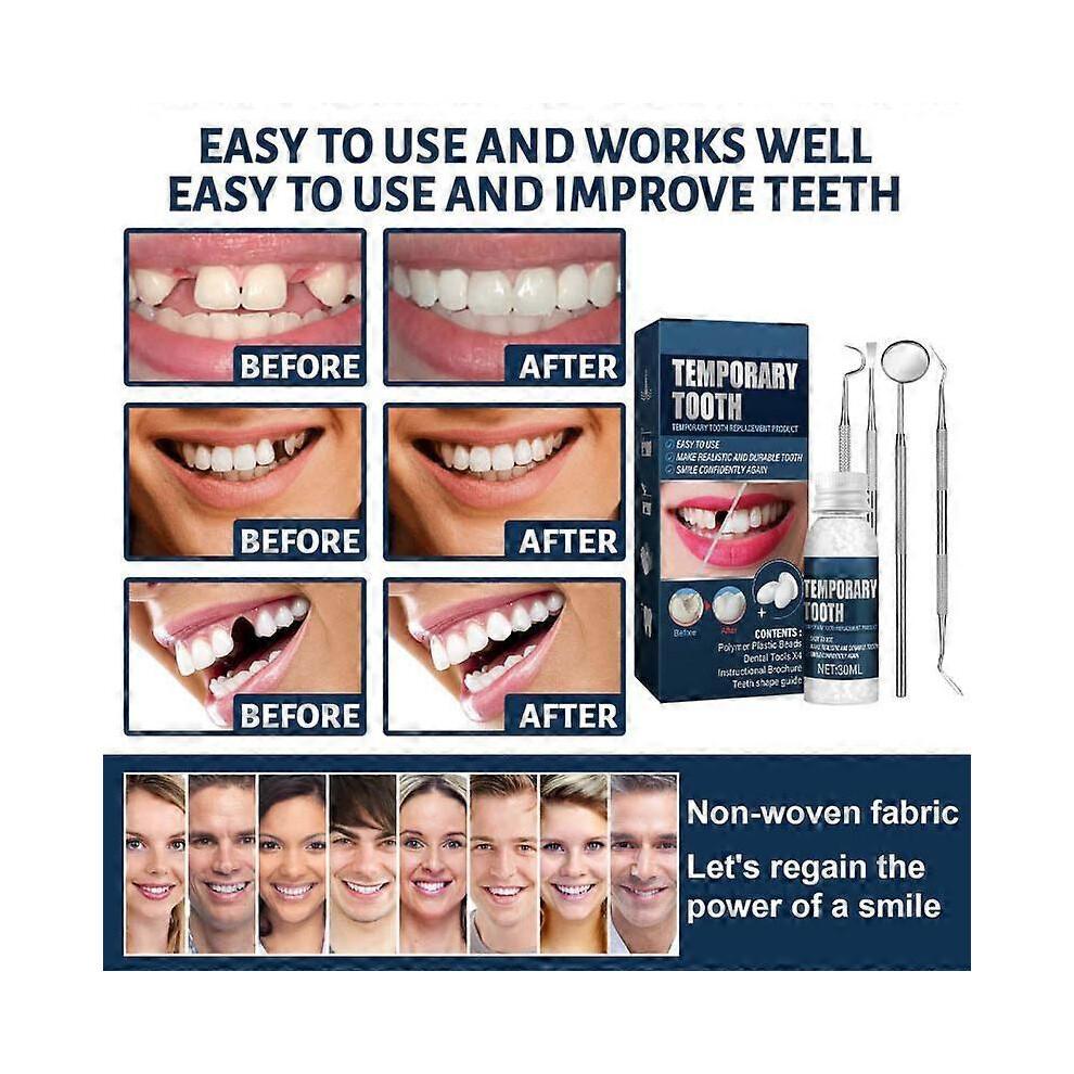 Temporary Tooth Repair Kit Fix Broken Teeth Fills Gaps Dental Denture Damage