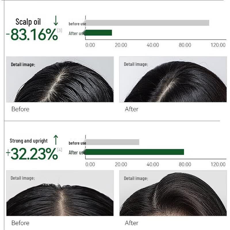 Long Hair Xiaozhai Rice Water Scalp Care Shampoo