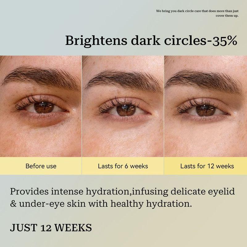 RoyueS - Vitamin C + Alpha Arbutin Eye Stick