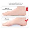 Silicone Arch Support Pad for Flat Feet and Bow Legs - Unisex Insole