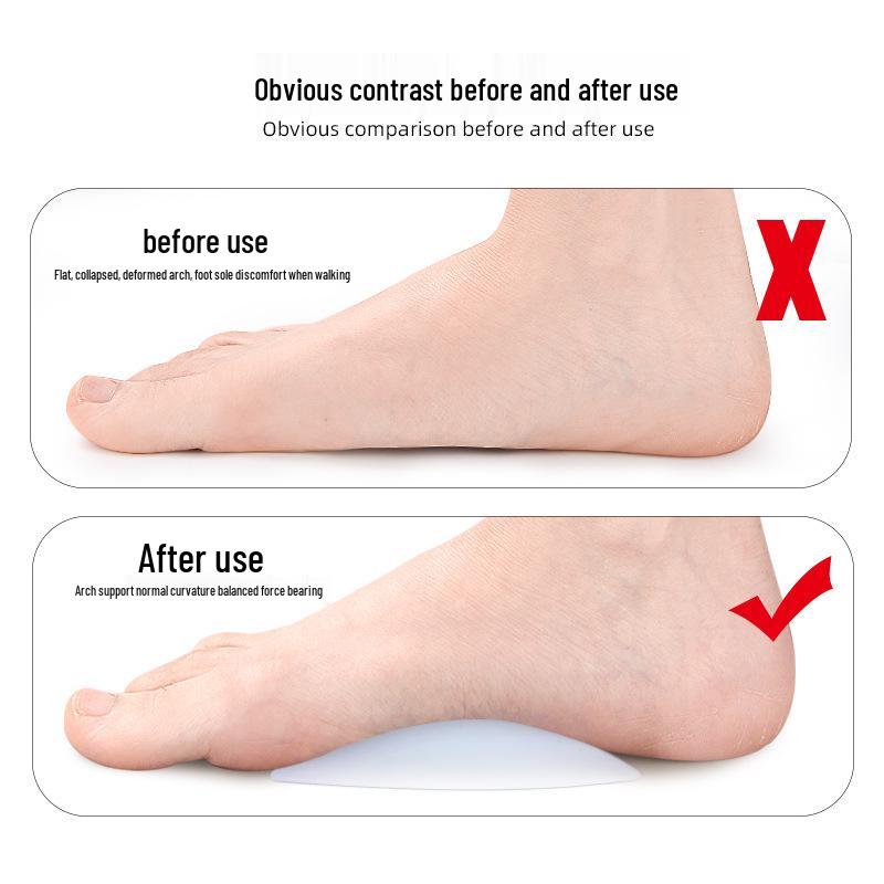 Silicone Arch Support Pad for Flat Feet and Bow Legs - Unisex Insole