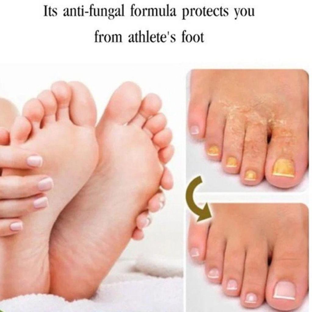 Gentle and Non-irritating, the Chapped Foot Repair Cream Hydrates and Nourishes the Skin, Leaving It Soft and Delicate